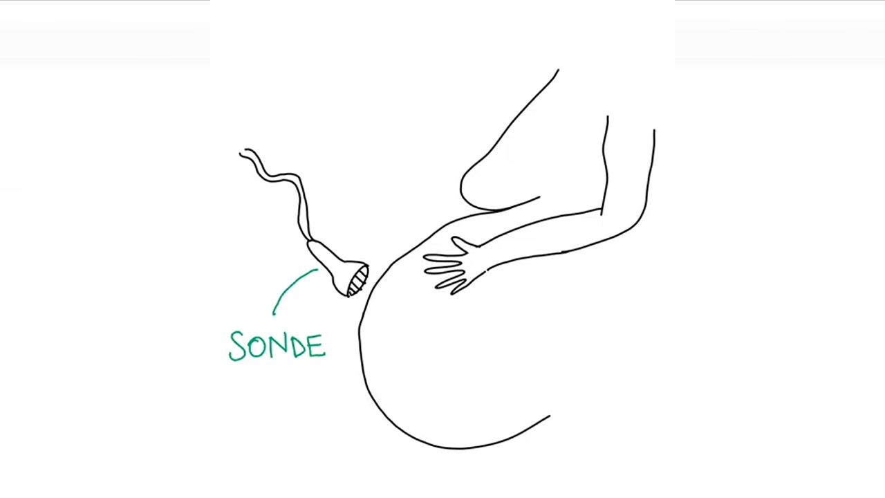Contour du côté gauche de la poitrine et de l’abdomen d’une femme enceinte, avec échographe orienté vers son ventre. Le mot sonde écrit en vert, avec une flèche qui pointe vers l’échographe.